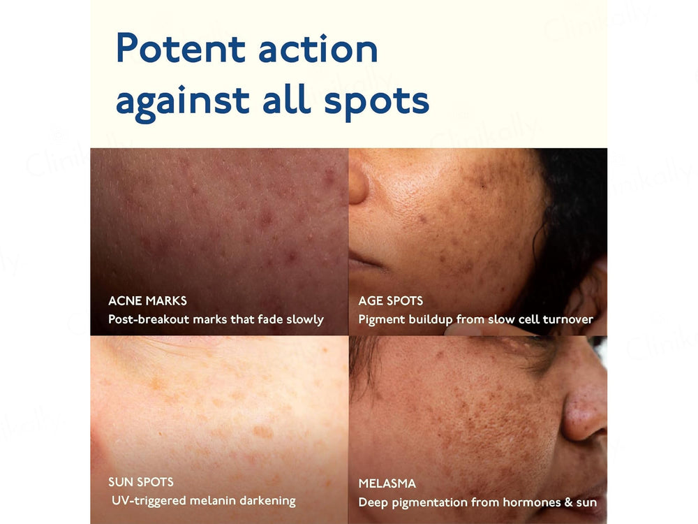 Asaya Advanced Spot Targeting Face Gel