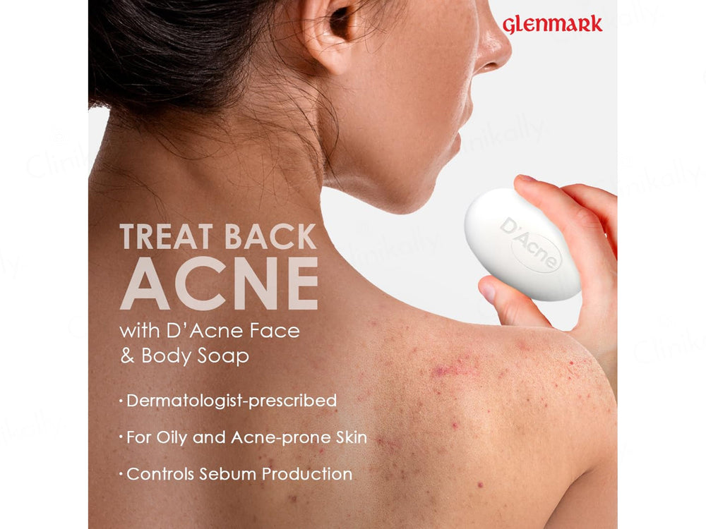 D'Acne Soap