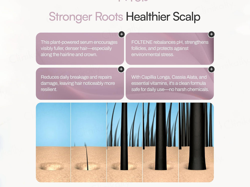 Foltene Pharma Hair & Scalp Treatment for Women