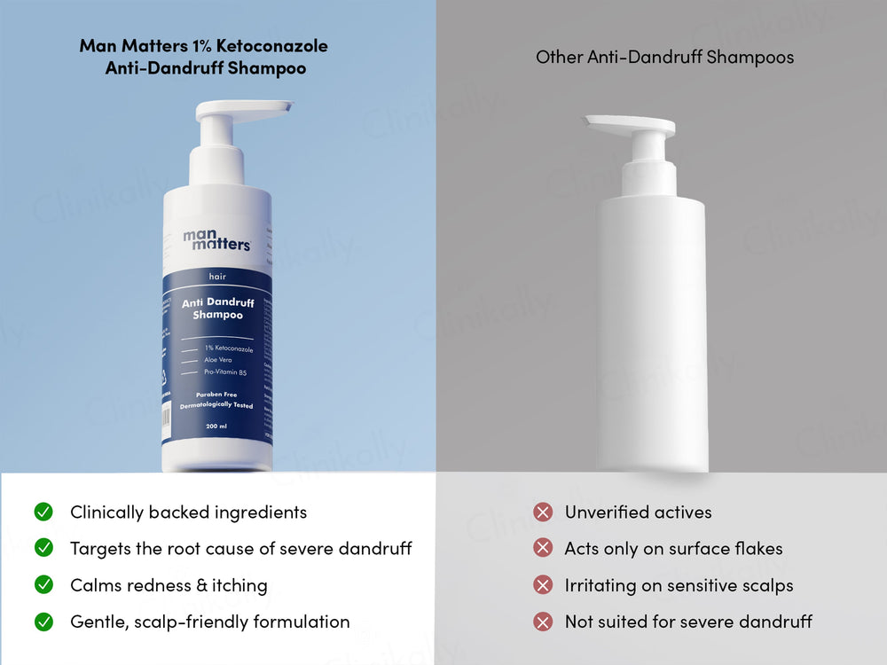 Man Matters Anti-Dandruff Shampoo
