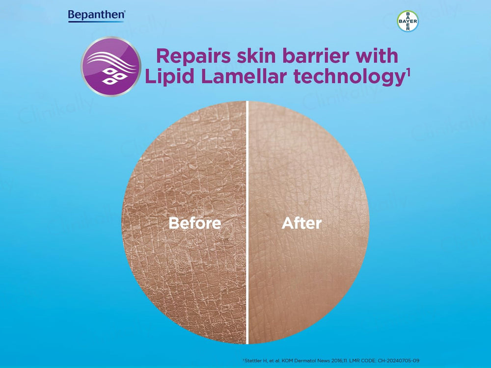 Bepanthen SensiCalm Steroid-Free Itch Relief Cream For Eczema-Prone Skin