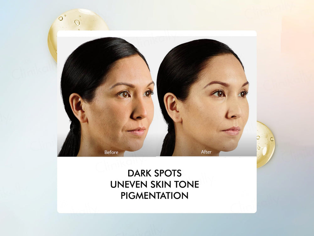 By Naked Fact Insta Care Vitamin C Serum