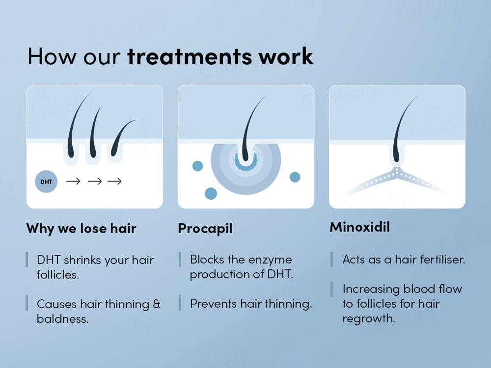 Man Matters Growmax 5% Hair Topical Solution